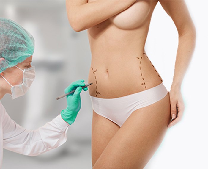body surgery